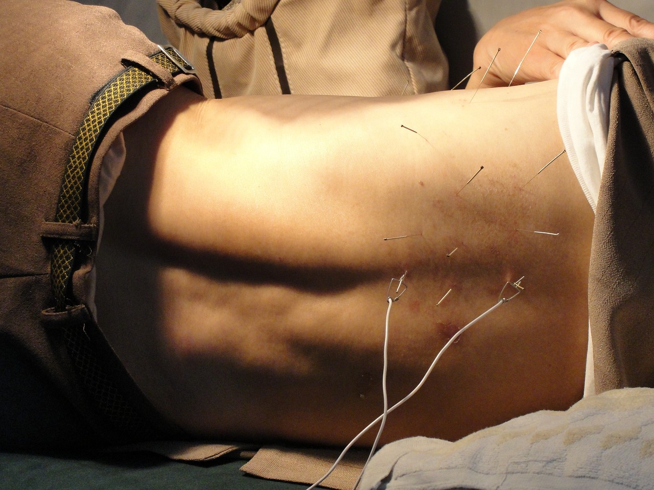 Can Acupuncture Improve Fertility? The Truth Unveiled
