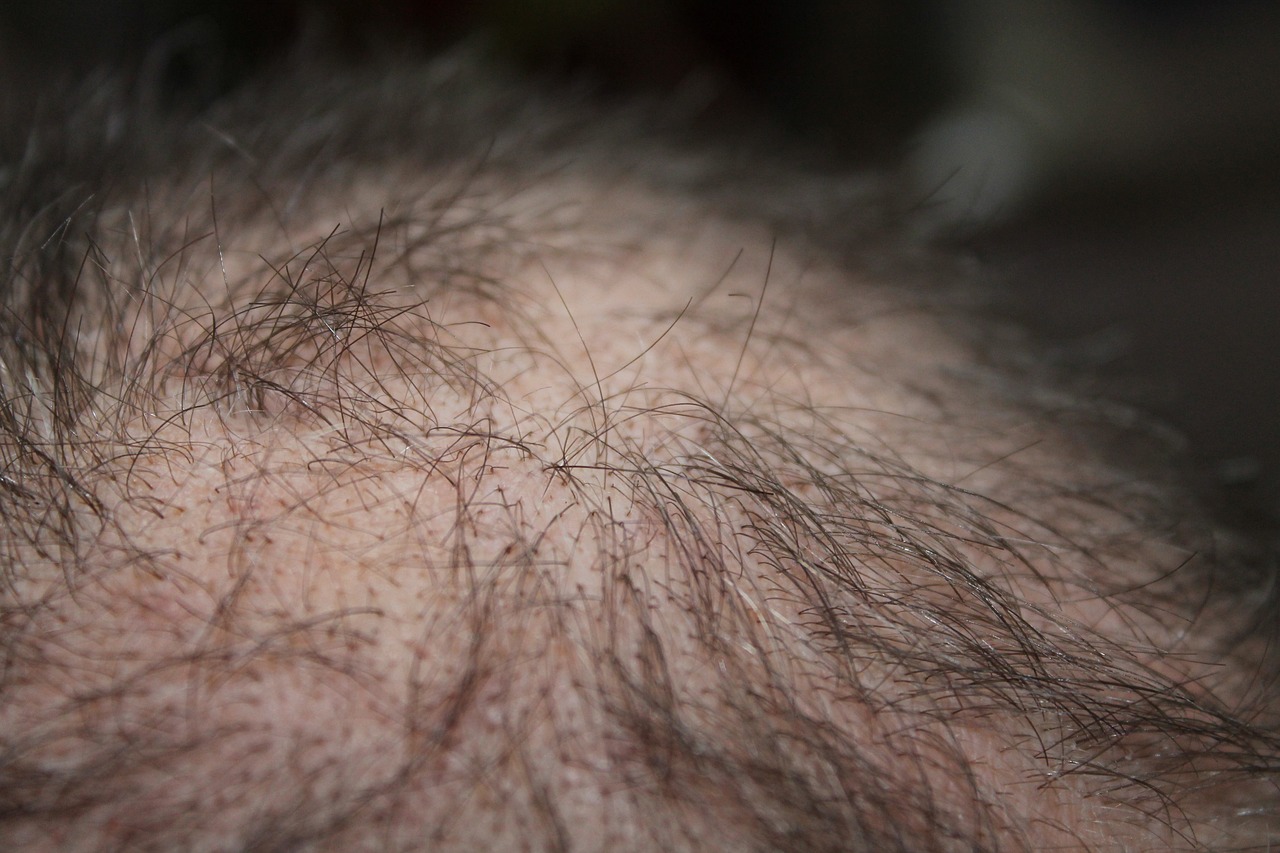 The Science behind Hair Loss: Understanding the Process